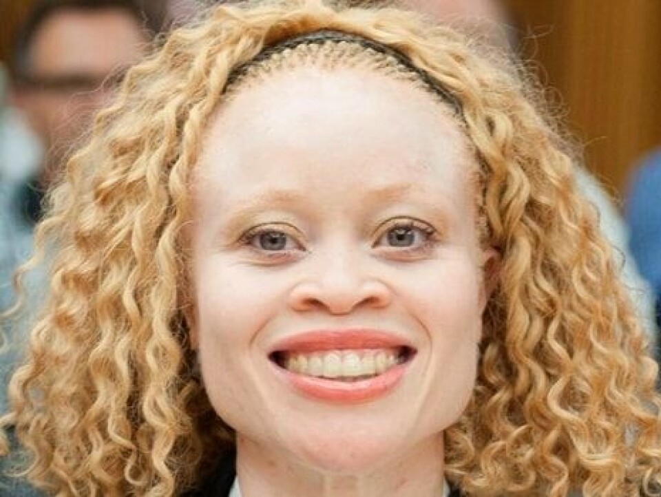 Albinism expert visits SA